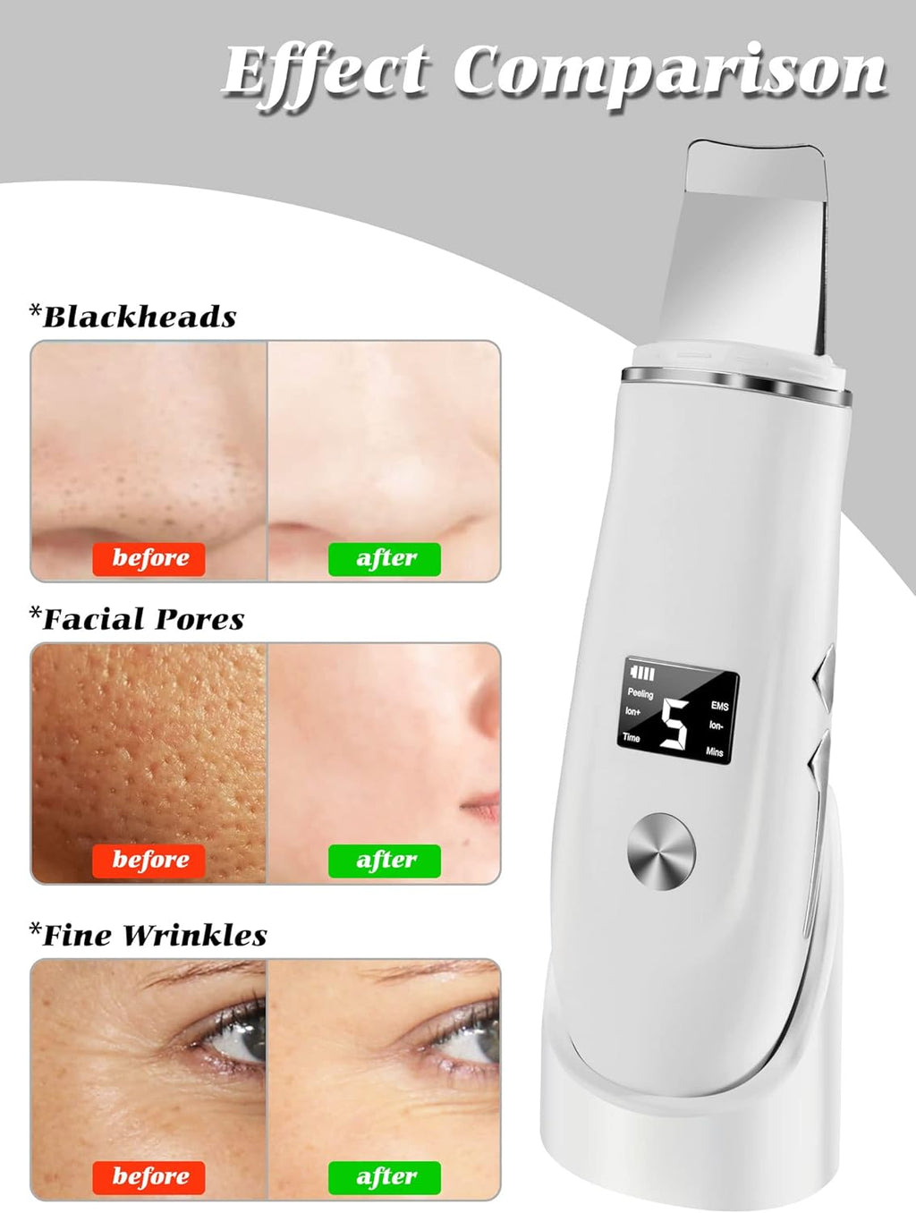 Ultrasonic Facial Skin Scrubber and Pore Cleanser