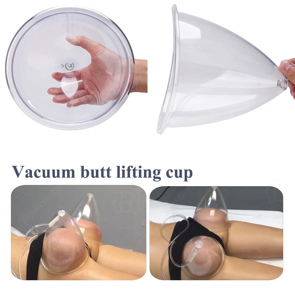 Vacuum Suction Cup Set for Breast and Buttock Enhancement