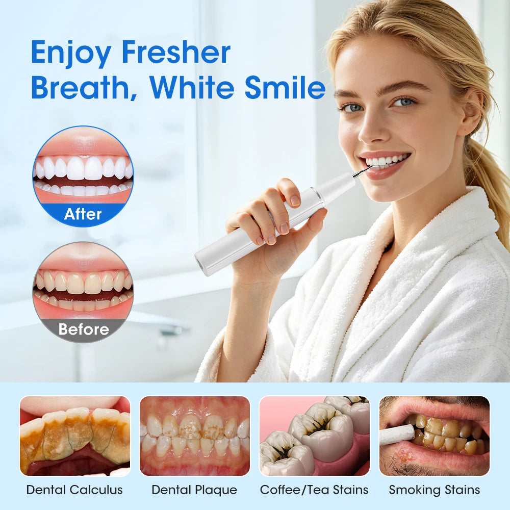 Ultrasonic Electric Teeth Plaque and Tartar Remover Kit
