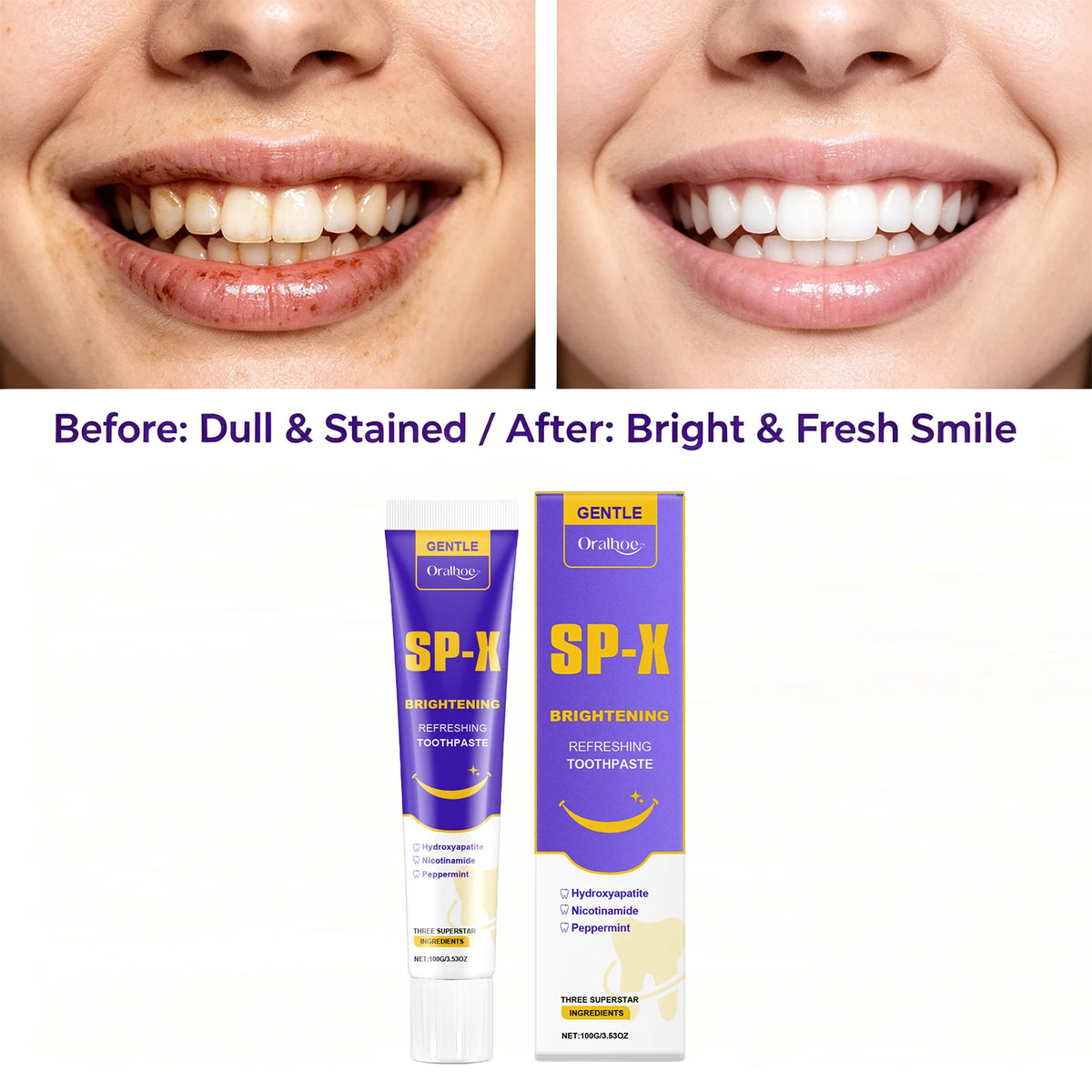 Brightening Teeth Whitening Toothpaste for Stain Removal