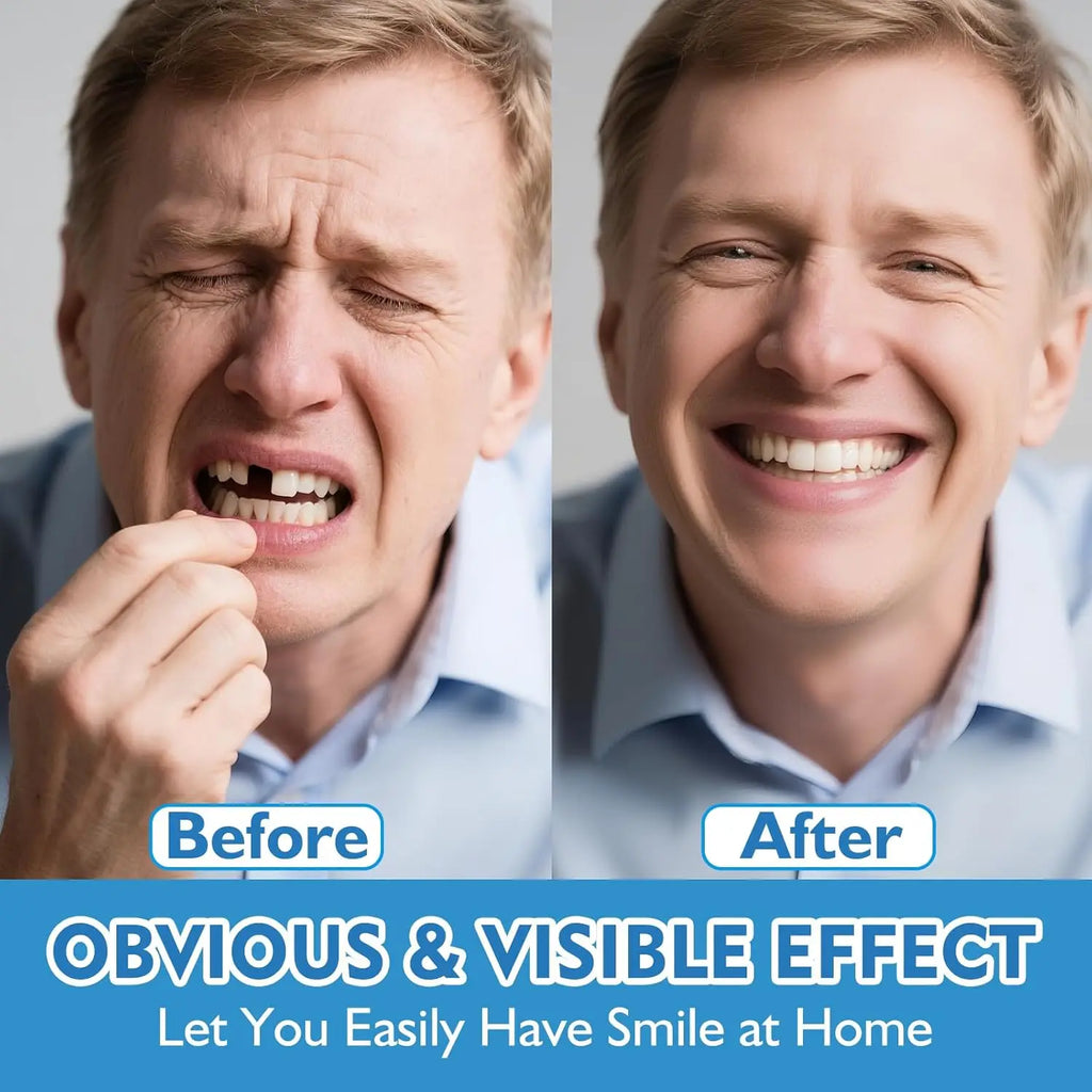 Comfort Fit Natural Look Dentures for Instant Smile Confidence