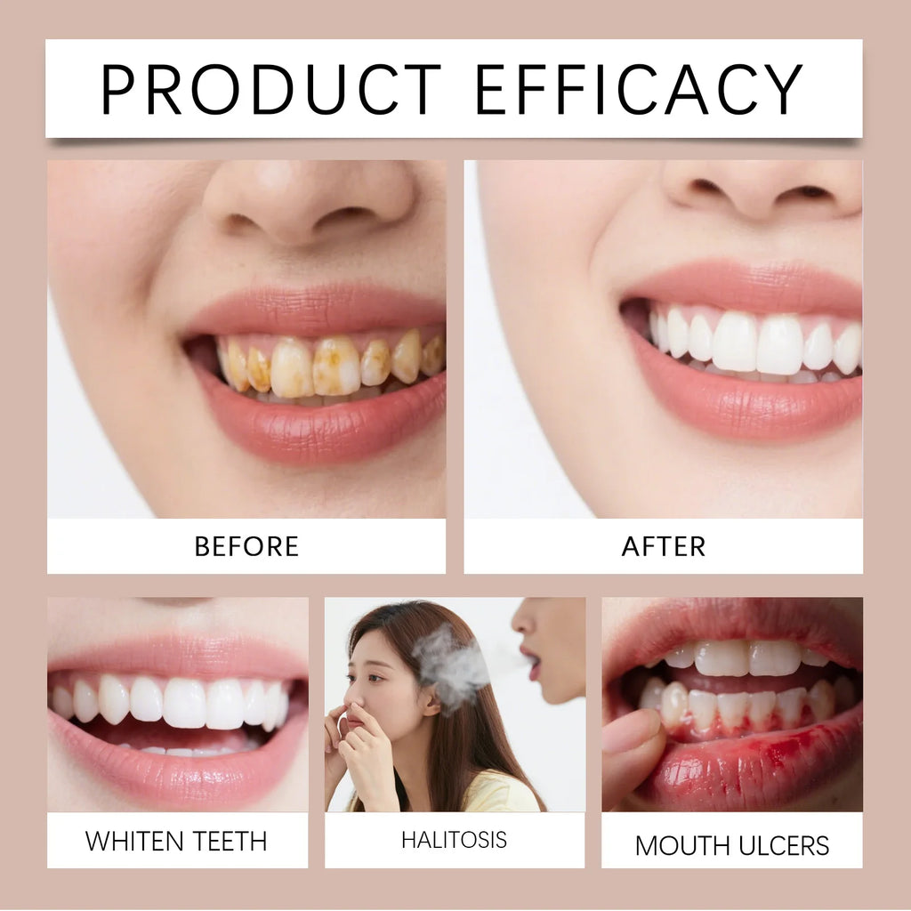 Clove Mint Oral Rinse for Fresh Breath and Teeth Whitening