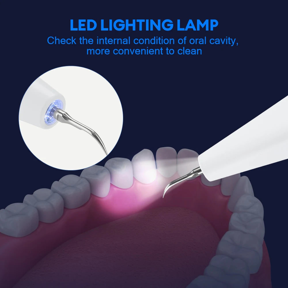 Ultrasonic Electric Dental Tartar and Plaque Remover