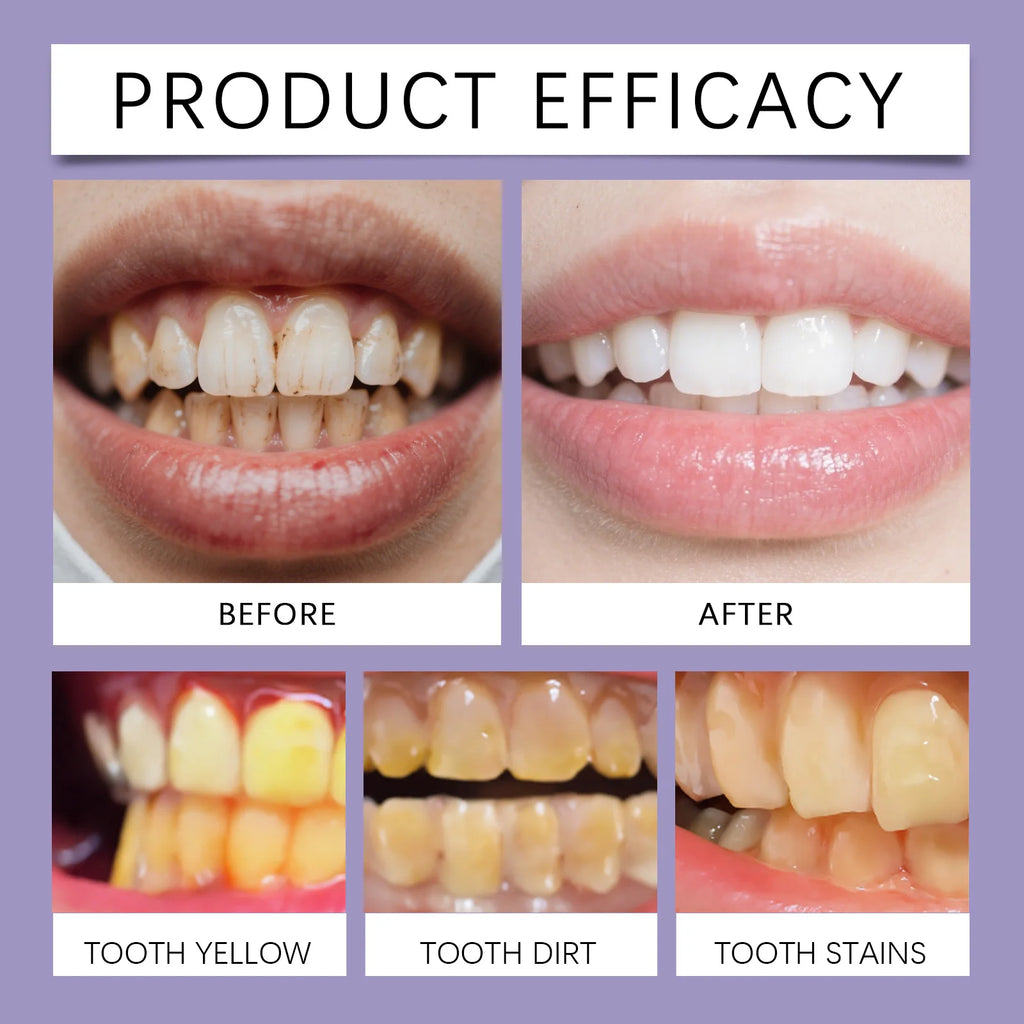 Bee Venom Gum Care and Teeth Whitening Toothpaste