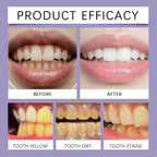 Bee Venom Gum Care and Teeth Whitening Toothpaste