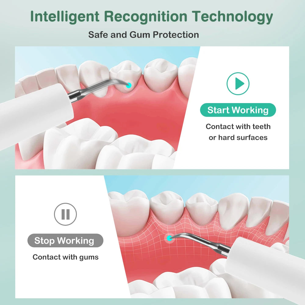 Electric Ultrasonic Teeth Tartar and Plaque Remover - 8