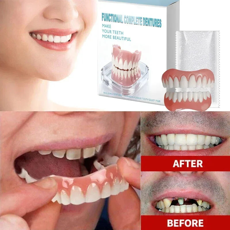 Instant Silicone Veneer Dentures for a Confident Smile - 1