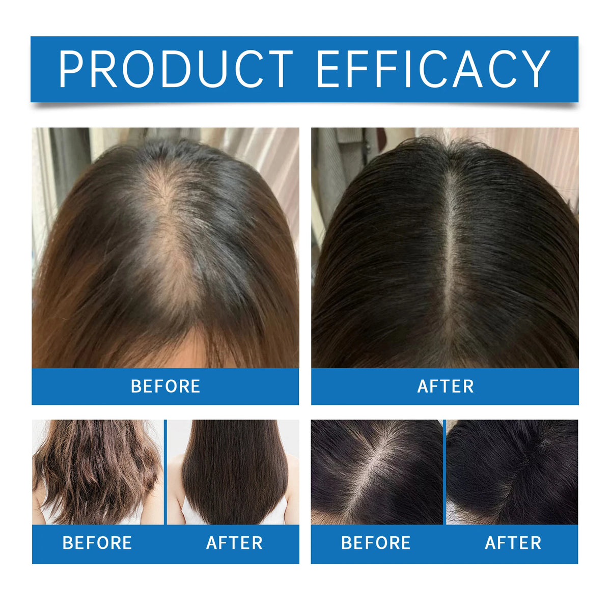Rosemary Scalp Stimulating Hair Growth Serum Roller