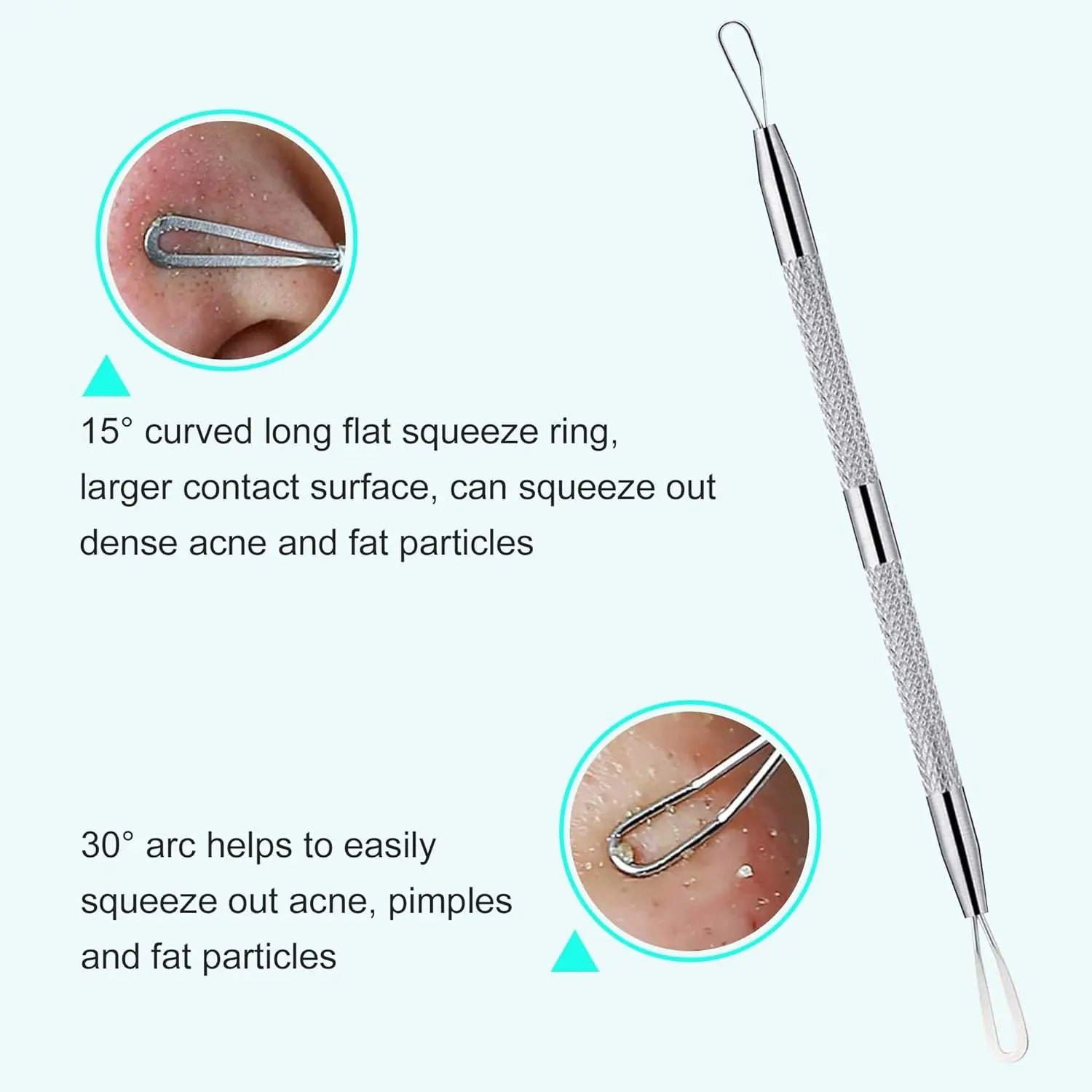 Stainless Steel Blackhead and Pimple Extractor Kit - 5