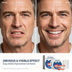 Snap-On Silicone Dentures for Natural Smile