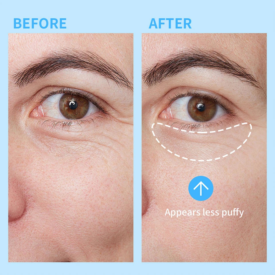 Cooling Eye Gel for Dark Circles and Puffiness - 11