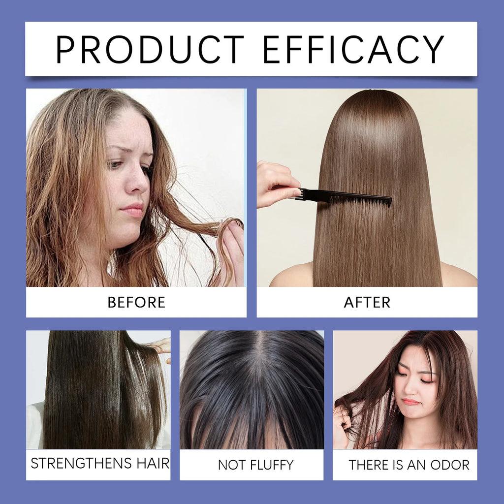 Selenium Disulfide Anti-Dandruff Scalp Treatment Shampoo
