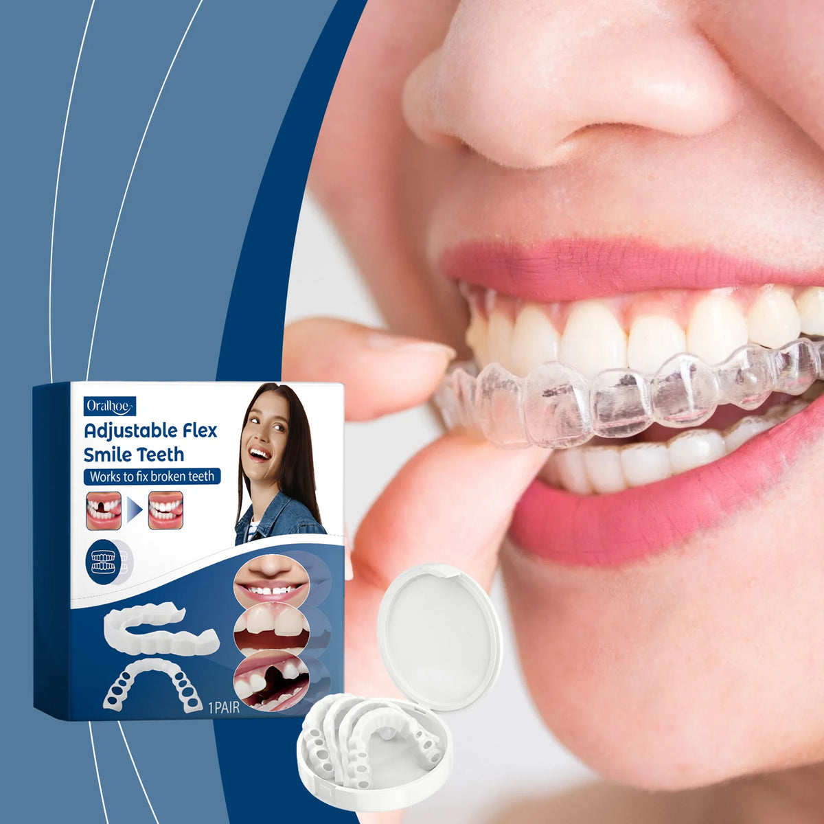 Adjustable Snap-On Dentures for Missing Teeth and Smile Correction
