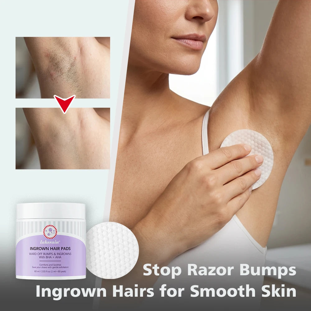 Ingrown Hair Treatment Pads for Razor Bumps and Exfoliation