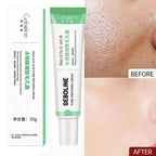 Salicylic Acid Pore Refining Cream for Acne and Blackheads