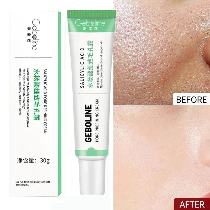 Salicylic Acid Pore Refining Cream for Acne and Blackheads