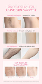 Painless Gentle Hair Removal Cream for Sensitive Body Areas