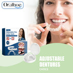 Adjustable Snap-On Dentures for Missing Teeth and Smile Correction