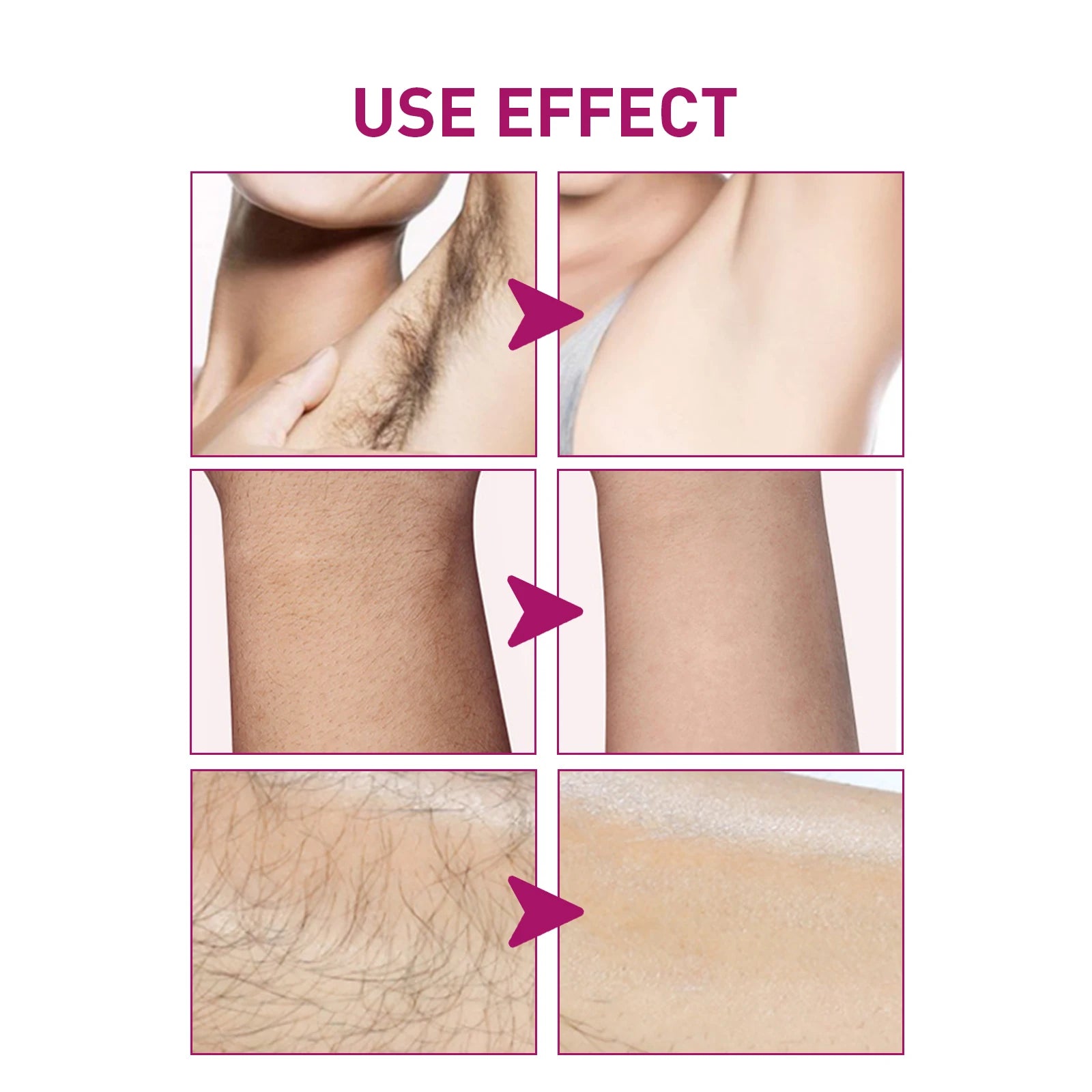 Painless Depilatory Cream for Quick Hair Removal - 4