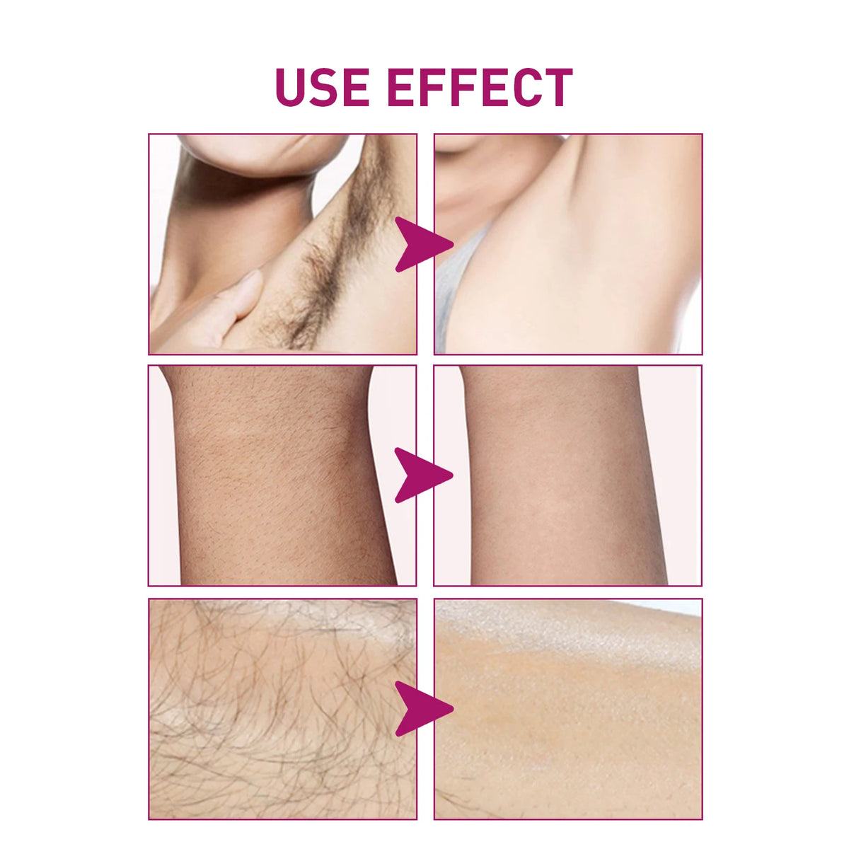 Painless Depilatory Cream for Quick Hair Removal