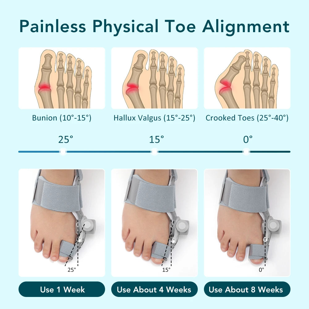 Adjustable Bunion Corrector for Hallux Valgus Support