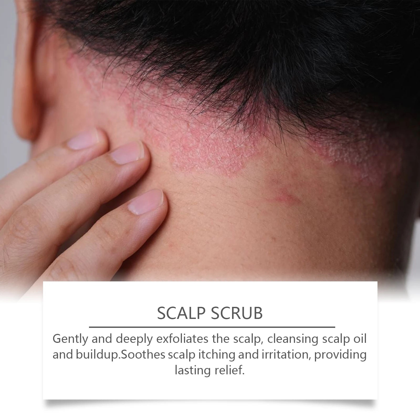 Deep Cleansing Exfoliating Scalp Scrub for Dandruff and Oily Hair - 9