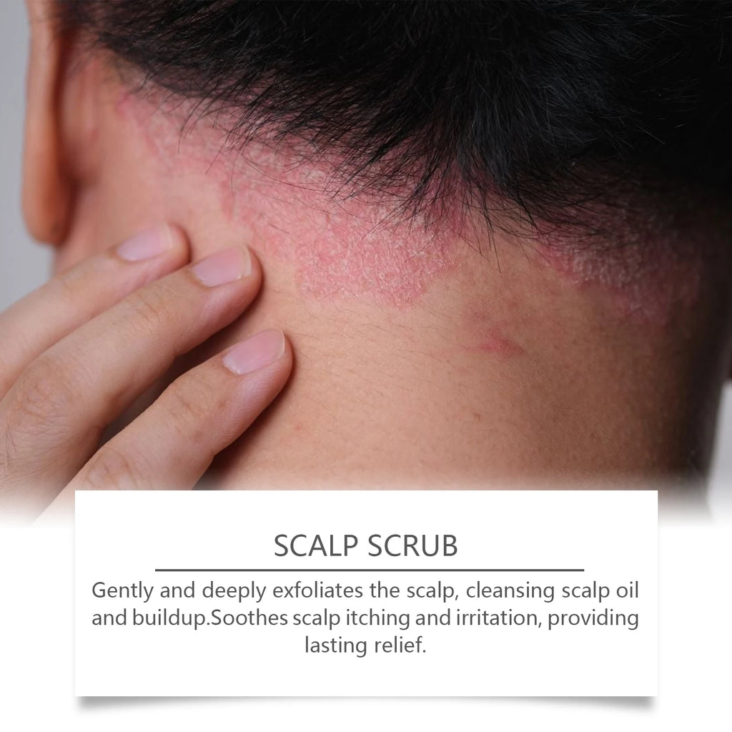 Deep Cleansing Exfoliating Scalp Scrub for Dandruff and Oily Hair