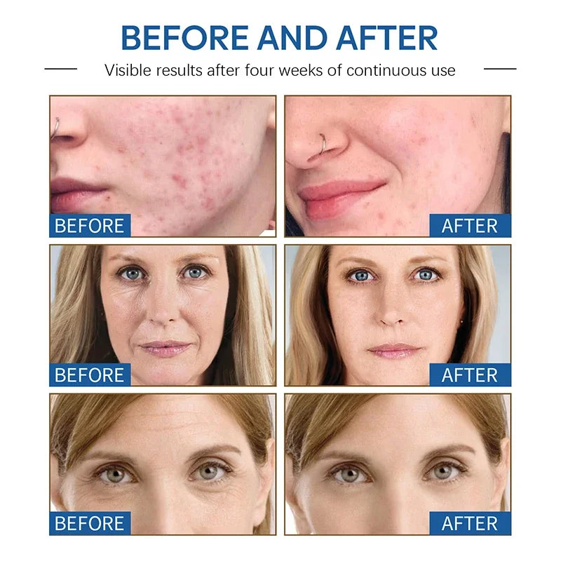 Anti-Wrinkle Moisturizing Face Cream for Firming and Lifting