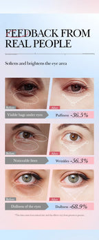 Anti-Wrinkle Retinol Eye Cream for Dark Circles and Puffiness