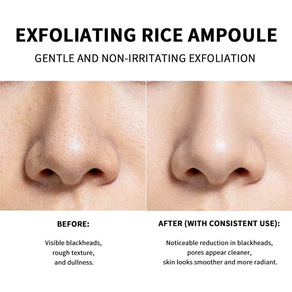 Exfoliating Rice Facial Peeling Essence - 11