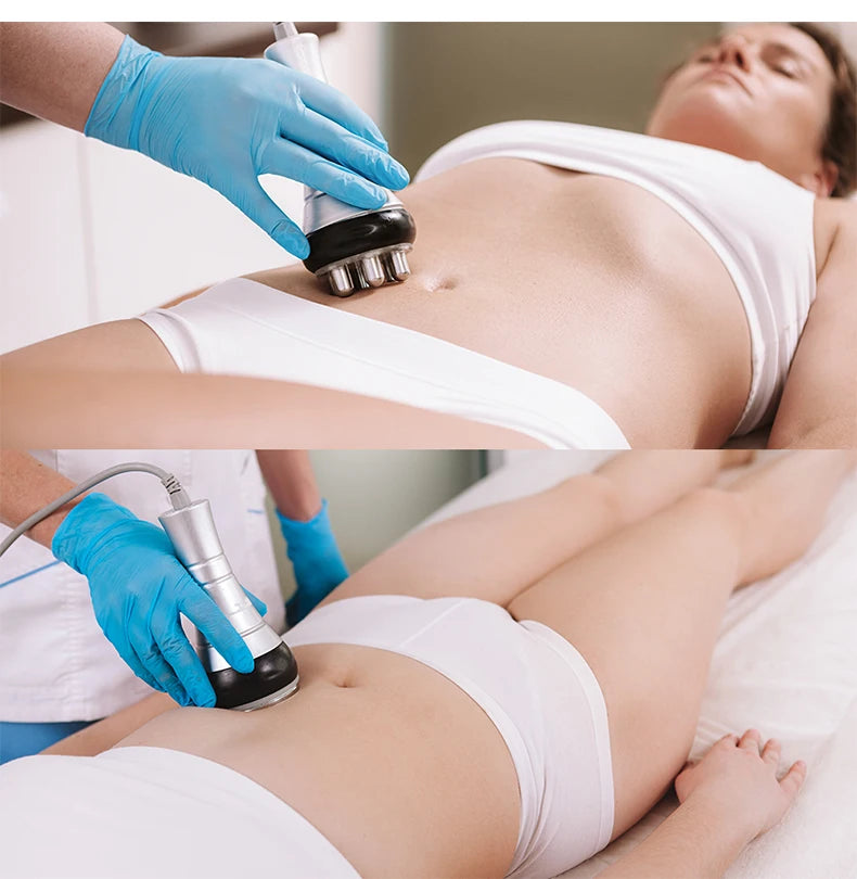 40K Ultrasonic Cavitation and RF Body Shaping Machine - 16