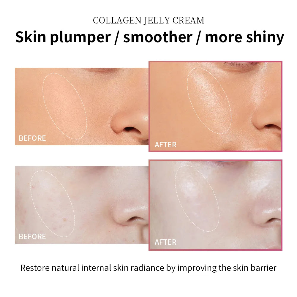Collagen Jelly Face Cream for Firming and Hydration