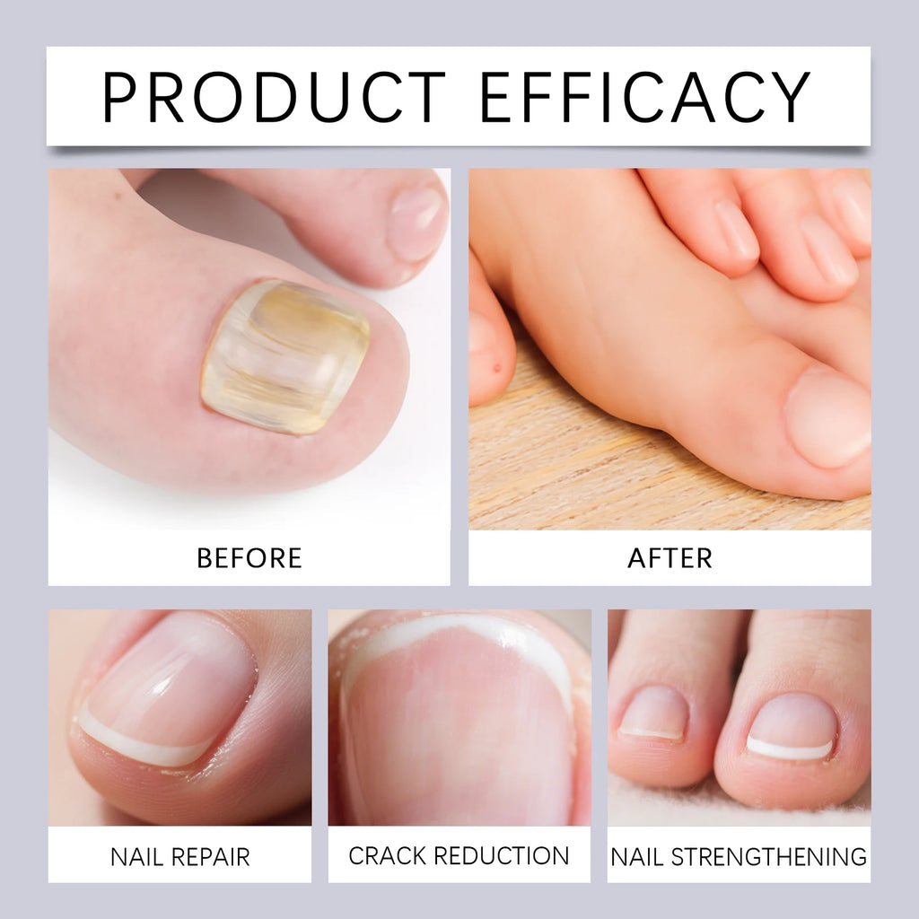 Nail Repair and Nourishing Cuticle Oil Pen