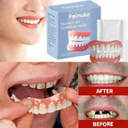 Temporary Silicone Dentures for Missing or Broken Teeth
