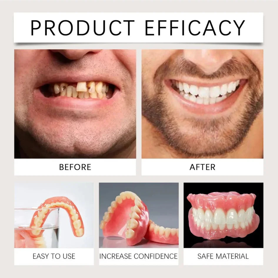 Instant Smile Cosmetic Dentures for Full Mouth - 3