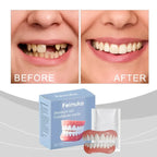 Temporary Silicone Dentures for Missing or Broken Teeth