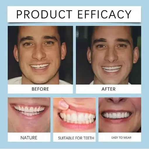 Flexible Silicone Denture Set for Natural Smile Replacement