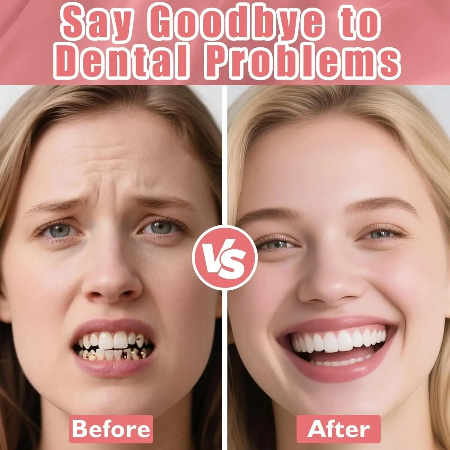 Realistic Temporary Denture Set for a Confident Smile - 10