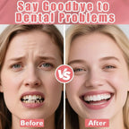 Realistic Temporary Denture Set for a Confident Smile
