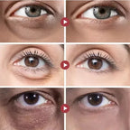 Anti-Wrinkle Retinol Eye Cream for Dark Circles and Puffiness