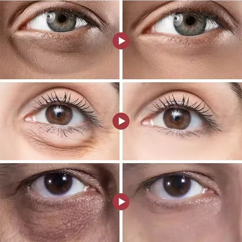 Anti-Wrinkle Retinol Eye Cream for Dark Circles and Puffiness