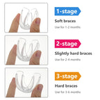 3-Stage Kids Dental Orthodontic Alignment Trainer and Retainer Set