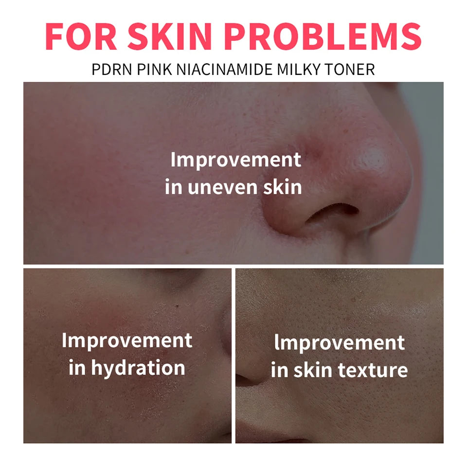 PDRN Niacinamide Milky Toner for Deep Hydration and Glow
