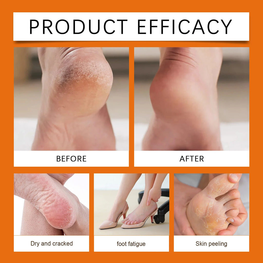 Moisturizing Honey Heel and Hand Repair Balm
