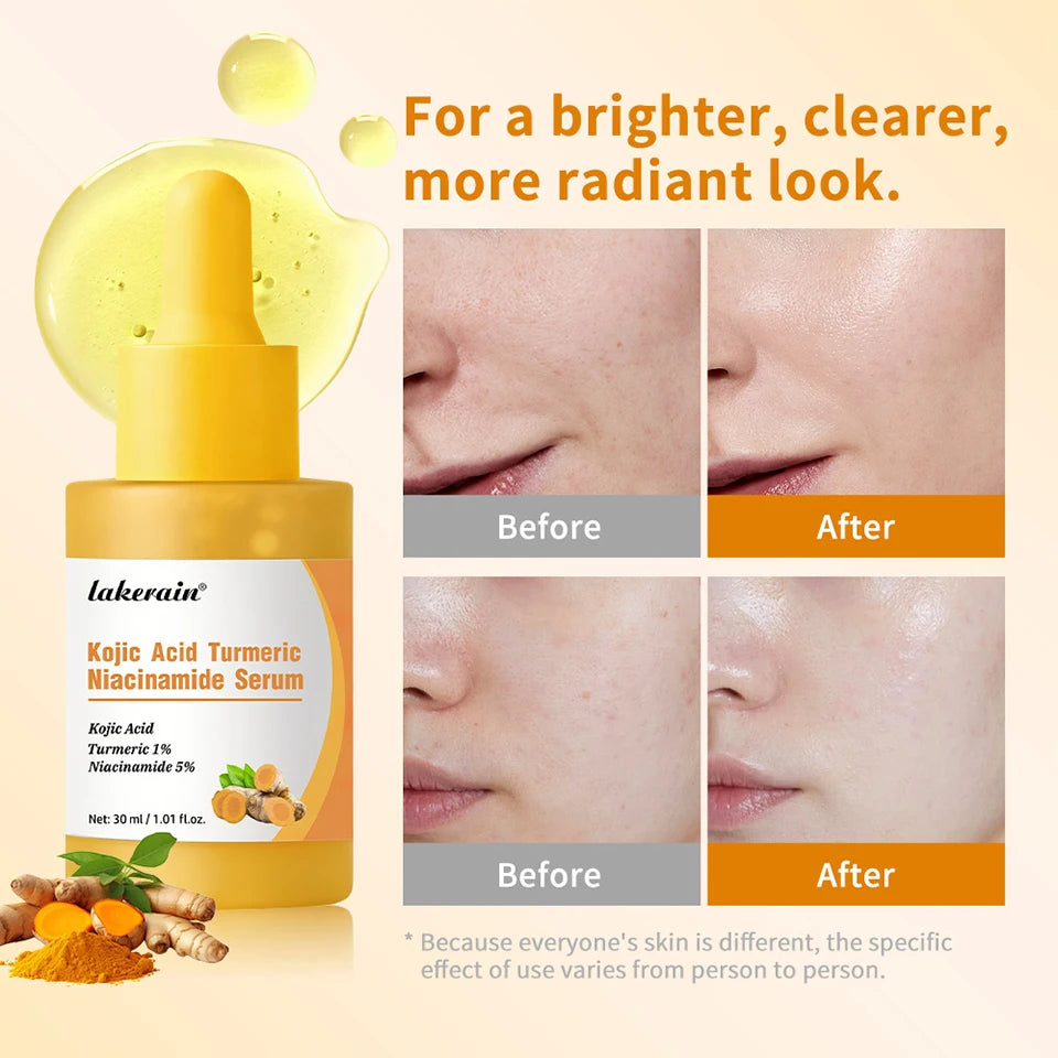 Brightening Kojic Acid and Turmeric Facial Serum - 11