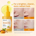 Brightening Kojic Acid and Turmeric Facial Serum