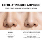 Exfoliating Rice Facial Peeling Essence