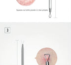 Stainless Steel Blackhead and Pimple Extractor Kit