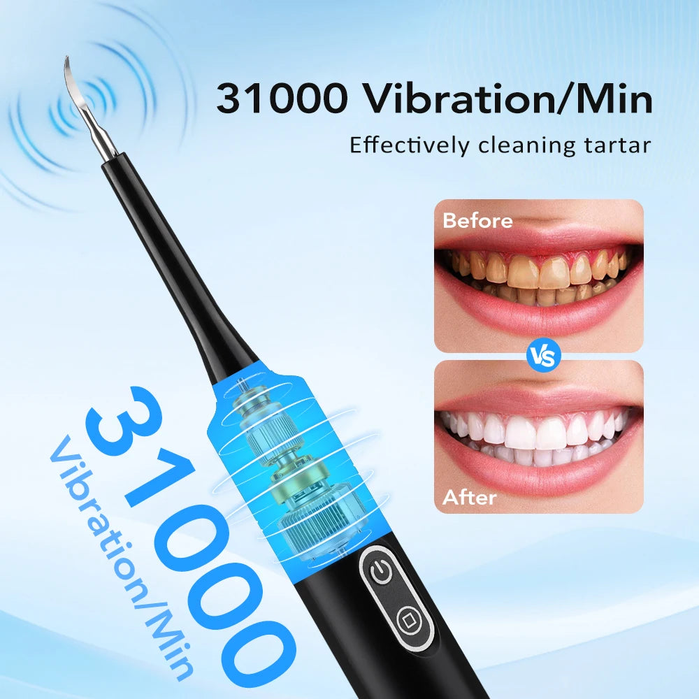 Electric Sonic Teeth Cleaner and Tartar Remover