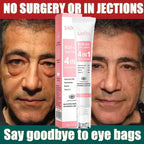 Anti-Wrinkle Retinol Eye Cream for Dark Circles and Puffiness